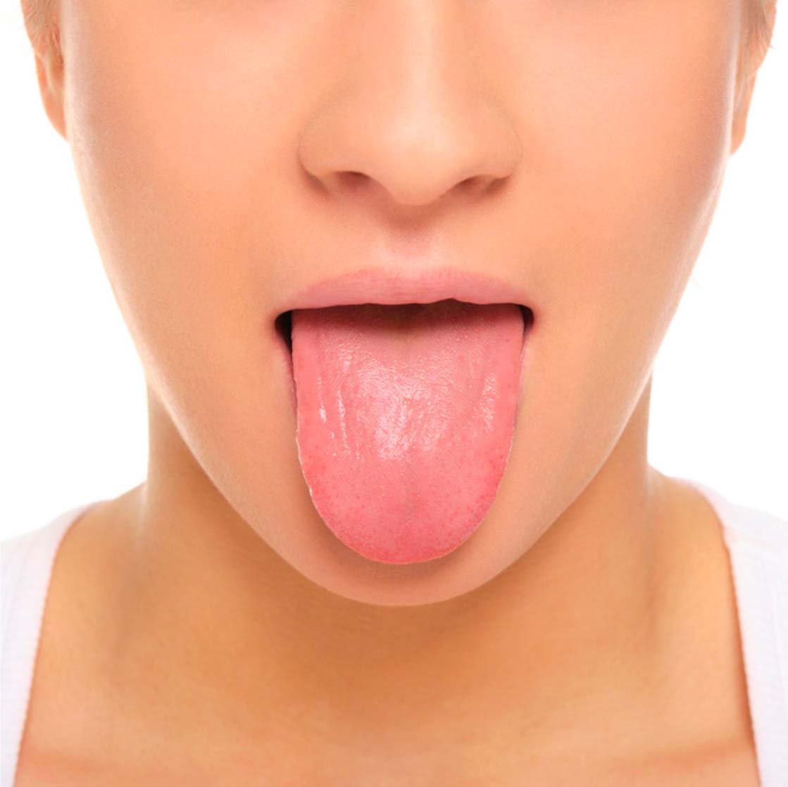LingUaLiSA_Francesconi_Dermatologia_post