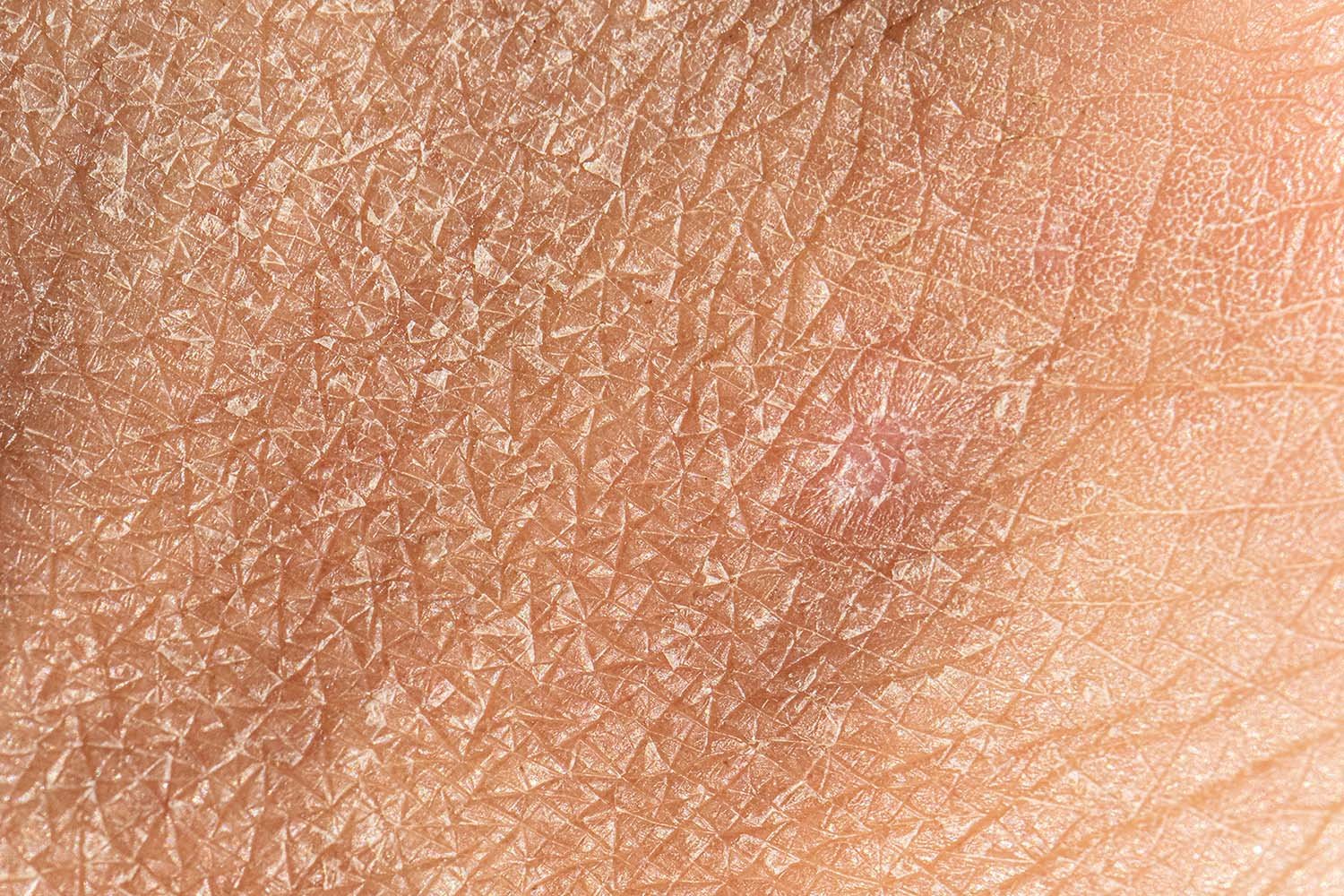 Dermatology,And,Skincare,Concept,With,A,Macro,View,On,The