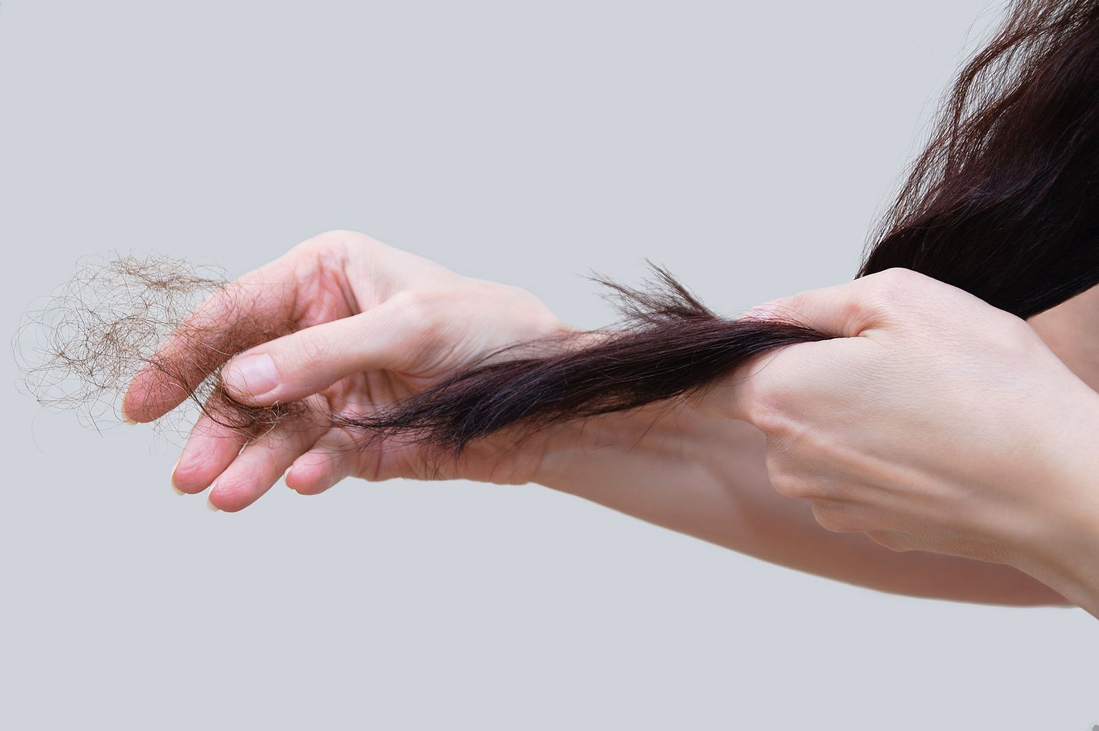 Hair,Loss.,Close-up,Of,A,Woman,With,Brown,Hairs,In